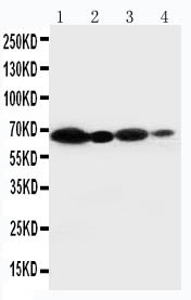 CYBB / NOX2 / gp91phox Antibody - WB of NOX2 / gp91phox antibody. All lanes: Anti-CYBB at 0.5ug/ml. Lane 1: HELA Whole Cell Lysate at 40ug. Lane 2: JURKAT Whole Cell Lysate at 40ug. Lane 3: MCF-7 Whole Cell Lysate at 40ug. Lane 4: SMMC Whole Cell Lysate at 40ug. Predicted bind size: 65KD. Observed bind size: 65KD.