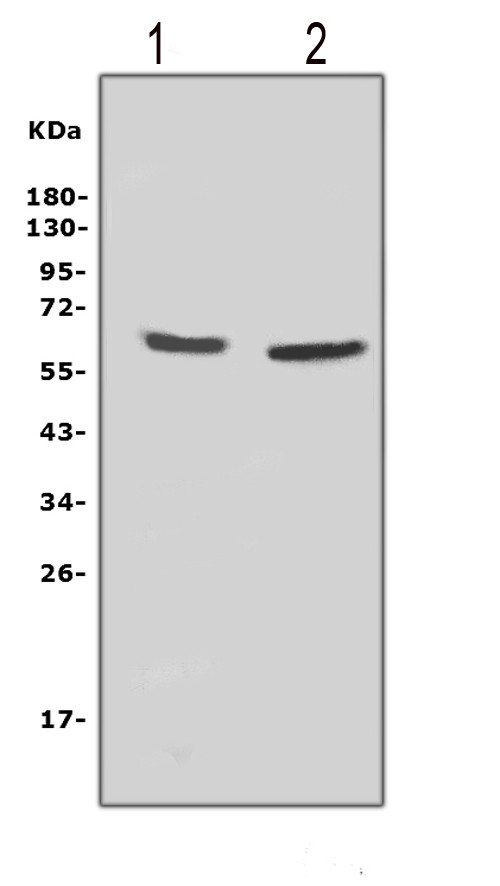 CYBB / NOX2 / gp91phox Antibody - Western blot analysis of NOX2 using anti-NOX2 antibody. Electrophoresis was performed on a 5-20% SDS-PAGE gel at 70V (Stacking gel) / 90V (Resolving gel) for 2-3 hours. The sample well of each lane was loaded with 50ug of sample under reducing conditions. Lane 1: rat thymus tissue lysates, Lane 2: rat brain tissue lysates, After Electrophoresis, proteins were transferred to a Nitrocellulose membrane at 150mA for 50-90 minutes. Blocked the membrane with 5% Non-fat Milk/ TBS for 1.5 hour at RT. The membrane was incubated with rabbit anti-NOX2 antigen affinity purified polyclonal antibody at 0.5 µg/mL overnight at 4°C, then washed with TBS-0.1% Tween 3 times with 5 minutes each and probed with a goat anti-rabbit IgG-HRP secondary antibody at a dilution of 1:10000 for 1.5 hour at RT. The signal is developed using an Enhanced Chemiluminescent detection (ECL) kit with Tanon 5200 system. A specific band was detected for NOX2 at approximately 65KD. The expected band size for NOX2 is at 65KD.