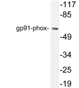 CYBB / NOX2 / gp91phox Antibody - Western blot analysis of lysate from HT29 cells, using gp91-phox antibody.