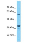 CYBB / NOX2 / gp91phox Antibody - NOX2 / gp91phox / gp91 phox antibody Western Blot of 721_B. Antibody dilution: 1 ug/ml.  This image was taken for the unconjugated form of this product. Other forms have not been tested.