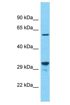 CYBB / NOX2 / gp91phox Antibody - NOX2 / gp91phox / gp91 phox antibody Western Blot of 721_B. Antibody dilution: 1 ug/ml.  This image was taken for the unconjugated form of this product. Other forms have not been tested.