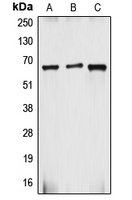 CYBB / NOX2 / gp91phox Antibody - Western blot analysis of gp91 phox expression in HepG2 (A); Caco2 (B); MCF7 (C) whole cell lysates.