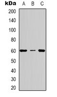CYBB / NOX2 / gp91phox Antibody - Western blot analysis of gp91 phox expression in MCF7 (A); HepG2 (B); K562 (C) whole cell lysates.