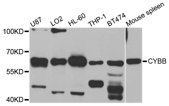 CYBB / NOX2 / gp91phox Antibody - Western blot analysis of extracts of various cell lines, using CYBB antibody at 1:1000 dilution. The secondary antibody used was an HRP Goat Anti-Rabbit IgG (H+L) at 1:10000 dilution. Lysates were loaded 25ug per lane and 3% nonfat dry milk in TBST was used for blocking. An ECL Kit was used for detection and the exposure time was 60s.