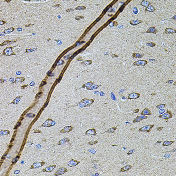 CYBB / NOX2 / gp91phox Antibody - Immunohistochemistry of paraffin-embedded rat brain using CYBB antibodyat dilution of 1:100 (40x lens).
