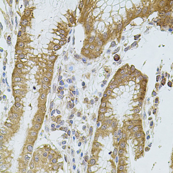 CYBB / NOX2 / gp91phox Antibody - Immunohistochemistry of paraffin-embedded human stomach using CYBB antibodyat dilution of 1:100 (40x lens).