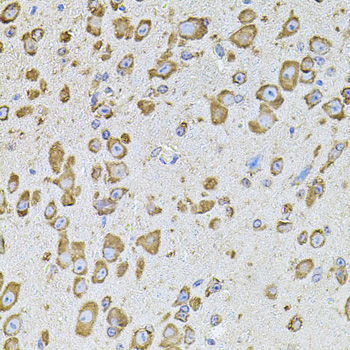 CYBB / NOX2 / gp91phox Antibody - Immunohistochemistry of paraffin-embedded mouse brain using CYBB antibodyat dilution of 1:100 (40x lens).
