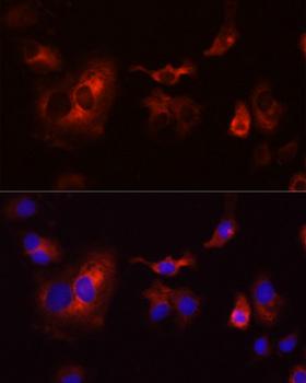 CYBB / NOX2 / gp91phox Antibody - Immunofluorescence analysis of A431 cells using CYBB antibodyat dilution of 1:100 (40x lens). Blue: DAPI for nuclear staining.