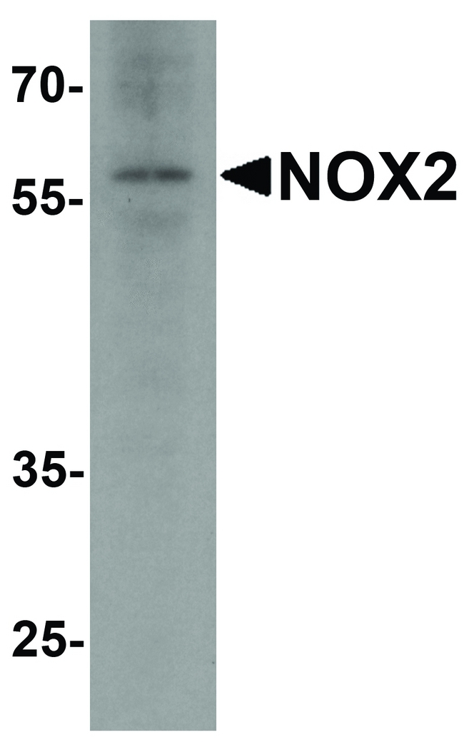 CYBB / NOX2 / gp91phox Antibody - Western blot analysis of NOX2 in rat brain tissue lysate with NOX2 antibody at 1 ug/ml.
