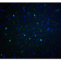 CYBB / NOX2 / gp91phox Antibody - Immunofluorescence of NOX2 in rat brain tissue with NOX2 antibody at 20 µg/ml.
