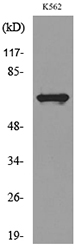 CYBB / NOX2 / gp91phox Antibody - Western blot analysis of lysate from K562 cells, using CYBB Antibody.