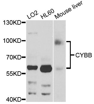 CYBB / NOX2 / gp91phox Antibody - Western blot analysis of extracts of various cell lines, using CYBB antibody at 1:1000 dilution. The secondary antibody used was an HRP Goat Anti-Rabbit IgG (H+L) at 1:10000 dilution. Lysates were loaded 25ug per lane and 3% nonfat dry milk in TBST was used for blocking. An ECL Kit was used for detection and the exposure time was 60s.