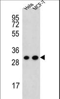 CYC1 / Cytochrome C-1 Antibody - CYC1 Antibody western blot of HeLa,MCF-7 cell line lysates (35 ug/lane). The CYC1 antibody detected the CYC1 protein (arrow).