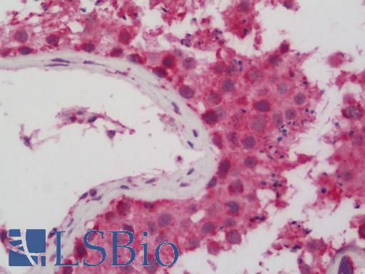 CYC1 / Cytochrome C-1 Antibody - Human Testis: Formalin-Fixed, Paraffin-Embedded (FFPE).  This image was taken for the unconjugated form of this product. Other forms have not been tested.