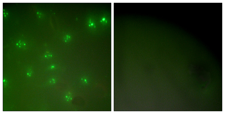 Cyclin A Antibody - Immunofluorescence analysis of COS7 cells, using Cyclin A Antibody. The picture on the right is blocked with the synthesized peptide.