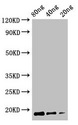 Cyclomaltodextrin glucanotransferase Antibody - Western Blot Positive WB detected in Recombinant protein All Lanes:CDGT2 antibody at 2.5µg/ml Secondary Goat polyclonal to rabbit IgG at 1/50000 dilution Predicted band size: 18 kDa Observed band size: 18 kDa