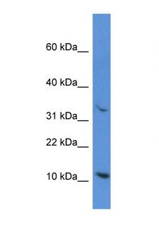CYCS / Cytochrome c Antibody - CYCS / Cytochrome c antibody Western blot of OVCAR-3 Cell lysate. Antibody concentration 1 ug/ml.  This image was taken for the unconjugated form of this product. Other forms have not been tested.
