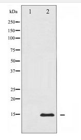 CYCS / Cytochrome c Antibody - Western blot of Cytochrome c expression in COS7 whole cell lysates,The lane on the left is treated with the antigen-specific peptide.