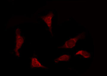 CYCS / Cytochrome c Antibody - Staining COS7 cells by IF/ICC. The samples were fixed with PFA and permeabilized in 0.1% Triton X-100, then blocked in 10% serum for 45 min at 25°C. The primary antibody was diluted at 1:200 and incubated with the sample for 1 hour at 37°C. An Alexa Fluor 594 conjugated goat anti-rabbit IgG (H+L) Ab, diluted at 1/600, was used as the secondary antibody.