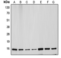 CYCS / Cytochrome c Antibody - Western blot analysis of Cytochrome c expression in HeLa (A); Jurkat (B); L929 (C); NIH3T3 (D); MCF7 (E); mouse kidney (F); rat heart (G) whole cell lysates.