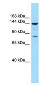 CYFIP1 Antibody - CYFIP1 antibody Western Blot of COLO205.  This image was taken for the unconjugated form of this product. Other forms have not been tested.