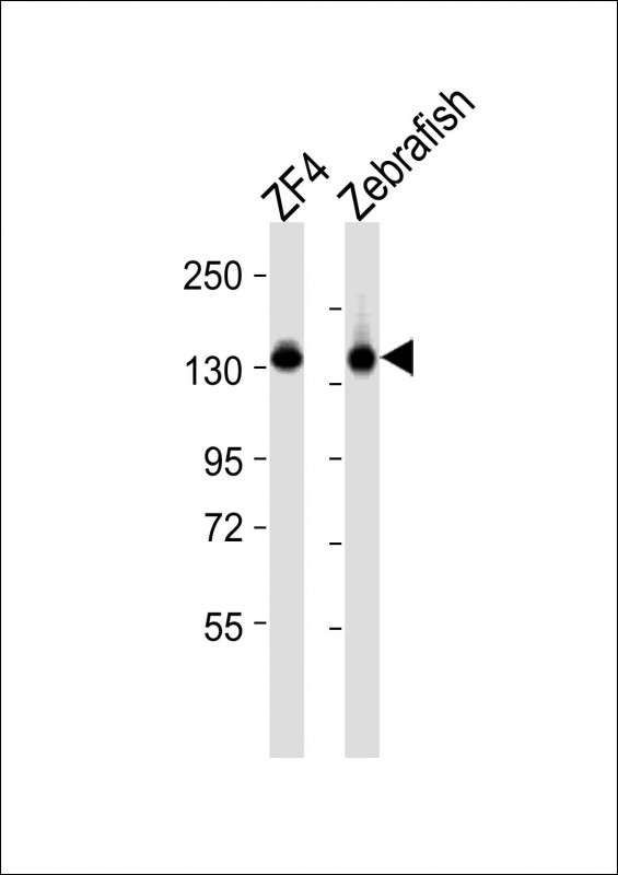 CYFIP1 Antibody - All lanes : Anti-cyfip1 Antibody at 1:2000 dilution Lane 1: ZF4 whole cell lysates Lane 2: Zebrafish lysates Lysates/proteins at 20 ug per lane. Secondary Goat Anti-Rabbit IgG, (H+L), Peroxidase conjugated at 1/10000 dilution Predicted band size : 145 kDa Blocking/Dilution buffer: 5% NFDM/TBST.