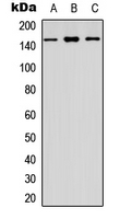 CYFIP1 Antibody - Western blot analysis of CYFIP1 expression in HEK293T (A); Raw264.7 (B); PC12 (C) whole cell lysates.