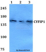 CYFIP1 Antibody - Western blot of CYFIP1 antibody at 1:500 dilution. Lane 1: HEK293T whole cell lysate. Lane 2: Raw264.7 whole cell lysate. Lane 3: PC12 whole cell lysate.