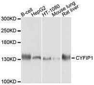 CYFIP1 Antibody - Western blot analysis of extracts of various cell lines, using CYFIP1 antibody at 1:1000 dilution. The secondary antibody used was an HRP Goat Anti-Rabbit IgG (H+L) at 1:10000 dilution. Lysates were loaded 25ug per lane and 3% nonfat dry milk in TBST was used for blocking. An ECL Kit was used for detection and the exposure time was 10s.