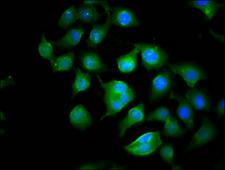 CYFIP1 Antibody - Immunofluorescence staining of A549 cells diluted at 1:100, counter-stained with DAPI. The cells were fixed in 4% formaldehyde, permeabilized using 0.2% Triton X-100 and blocked in 10% normal Goat Serum. The cells were then incubated with the antibody overnight at 4°C.The Secondary antibody was Alexa Fluor 488-congugated AffiniPure Goat Anti-Rabbit IgG (H+L).