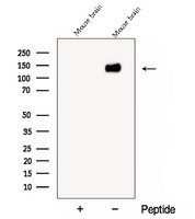 CYFIP2 / PIR121 Antibody - Western blot analysis of extracts of COS-7 cells using CYFIP2 antibody. The lane on the left was treated with blocking peptide.