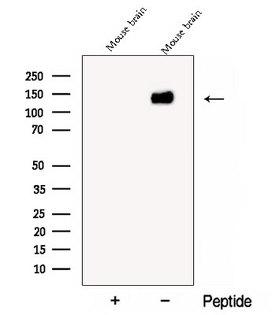 CYFIP2 / PIR121 Antibody - Western blot analysis of extracts of COS-7 cells using CYFIP2 antibody. The lane on the left was treated with blocking peptide.