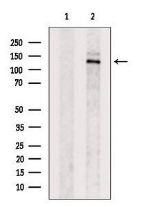 CYFIP2 / PIR121 Antibody