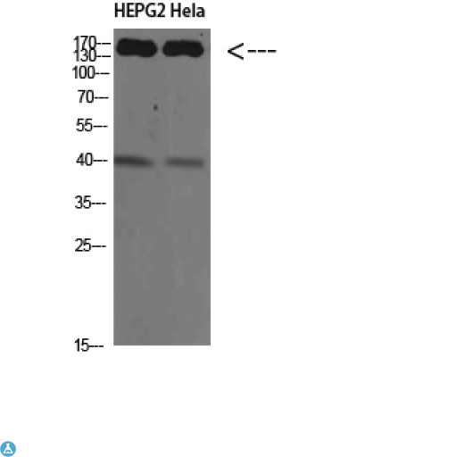 CYFIP2 / PIR121 Antibody - Western Blot (WB) analysis of HepG2 HeLa cells using CYFIP2 Polyclonal Antibody diluted at 1:500.