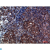 CYFIP2 / PIR121 Antibody - Immunohistochemical analysis of paraffin-embedded human-tonsil, antibody was diluted at 1:200.