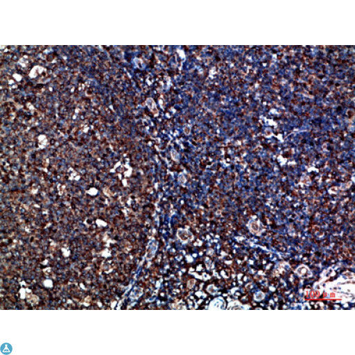CYFIP2 / PIR121 Antibody - Immunohistochemical analysis of paraffin-embedded human-tonsil, antibody was diluted at 1:200.