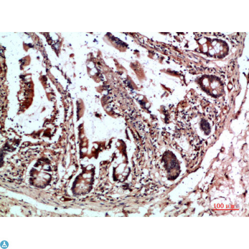CYFIP2 / PIR121 Antibody - Immunohistochemical analysis of paraffin-embedded human-colon, antibody was diluted at 1:200.