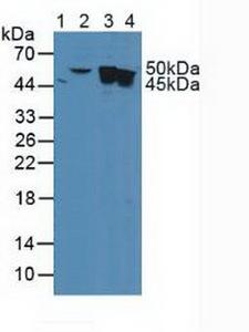 CYFRA21-1 Antibody