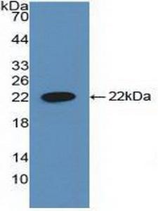 CYFRA21-1 Antibody