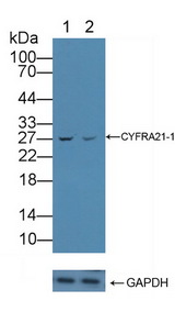 CYFRA21-1 Antibody - Knockout Varification: Lane 1: Wild-type MCF7 cell lysate; Lane 2: CYFRA21-1 knockout MCF7 cell lysate; Predicted MW: 44kd Observed MW: 50kd Primary Ab: 5µg/ml Rabbit Anti-Human CYFRA21-1 Antibody Second Ab: 0.2µg/mL HRP-Linked Caprine Anti-Rabbit IgG Polyclonal Antibody