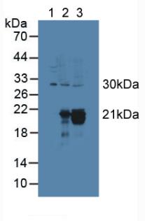 CYGB / Cytoglobin Antibody - Western Blot; Lane1: Rat Serum; Lane2: Rat Heart Tissue; Lane3: Rat Kidney Tissue.