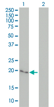 CYGB / Cytoglobin Antibody - Western blot of CYGB expression in transfected 293T cell line by CYGB monoclonal antibody (M02), clone 1A1.