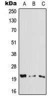 CYGB / Cytoglobin Antibody - Western blot analysis of Cytoglobin expression in HeLa (A); Raw264.7 (B); PC12 (C) whole cell lysates.
