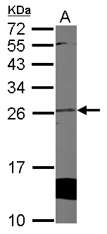 CYGB / Cytoglobin Antibody - Sample (50 ug of whole cell lysate) A: mouse heart 12% SDS PAGE CYGB / Cytoglobin antibody diluted at 1:1000