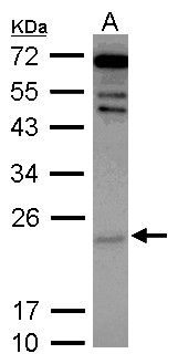 CYGB / Cytoglobin Antibody - Sample (30 ug of whole cell lysate) A: IMR32 12% SDS PAGE CYGB / Cytoglobin antibody diluted at 1:2000