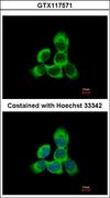 CYGB / Cytoglobin Antibody - Immunofluorescence of methanol-fixed A431, using Cytoglobin antibody at 1:500 dilution.
