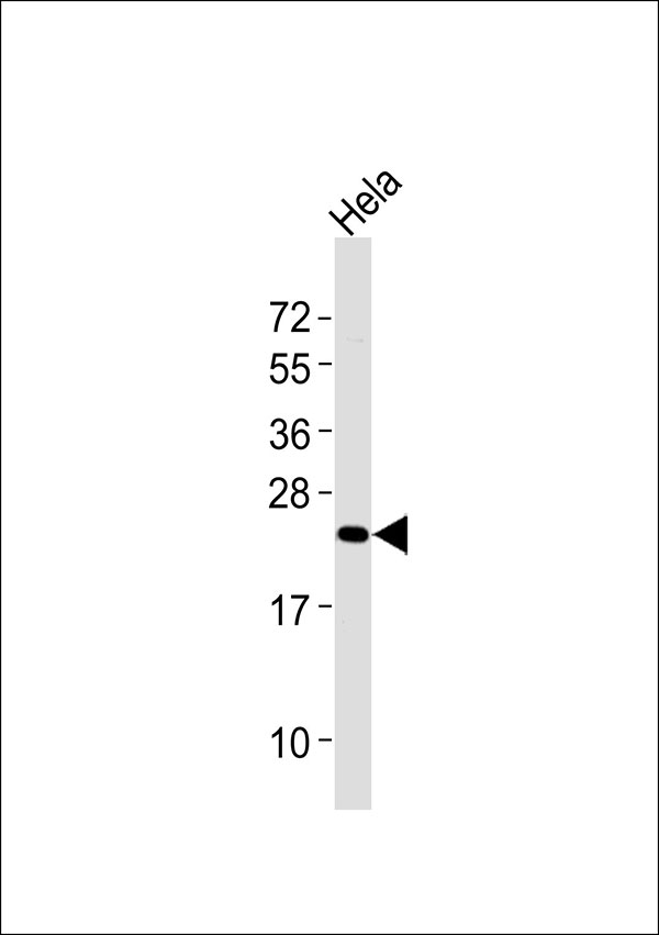 CYGB / Cytoglobin Antibody - Anti-Cytoglobin Antibody at 1:1000 dilution + HeLa whole cell lysates Lysates/proteins at 20 ug per lane. Secondary Goat Anti-Rabbit IgG, (H+L),Peroxidase conjugated at 1/10000 dilution Predicted band size : 21 kDa Blocking/Dilution buffer: 5% NFDM/TBST.