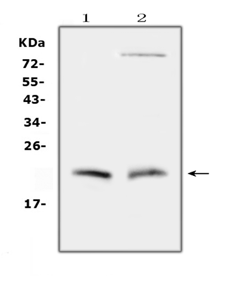 CYGB / Cytoglobin Antibody - Western blot analysis of Cytoglobin using anti-Cytoglobin antibody. Electrophoresis was performed on a 5-20% SDS-PAGE gel at 70V (Stacking gel) / 90V (Resolving gel) for 2-3 hours. The sample well of each lane was loaded with 50ug of sample under reducing conditions. Lane 1: rat small intestine tissue lysates, Lane 2: mouse small intestine tissue lysates, After Electrophoresis, proteins were transferred to a Nitrocellulose membrane at 150mA for 50-90 minutes. Blocked the membrane with 5% Non-fat Milk/ TBS for 1.5 hour at RT. The membrane was incubated with rabbit anti-Cytoglobin antigen affinity purified polyclonal antibody at 0.5 µg/mL overnight at 4°C, then washed with TBS-0.1% Tween 3 times with 5 minutes each and probed with a goat anti-rabbit IgG-HRP secondary antibody at a dilution of 1:10000 for 1.5 hour at RT. The signal is developed using an Enhanced Chemiluminescent detection (ECL) kit with Tanon 5200 system. A specific band was detected for Cytoglobin at approximately 21KD. The expected band size for Cytoglobin is at 21KD.