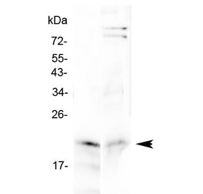 CYGB / Cytoglobin Antibody - Western blot testing of 1) rat small intestine and 2) mouse small intestine lysate with Cytoglobin antibody at 0.5ug/ml. Predicted molecular weight ~21 kDa.