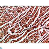 CYGB / Cytoglobin Antibody - Immunohistochemical analysis of paraffin-embedded Human-heart, antibody was diluted at 1:100.